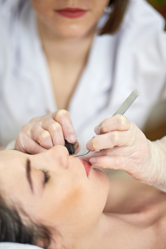 Epilation Oberlippe